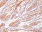  Carcinoembryonic Antigen (CEA) / CD66 Antibody - With BSA and Azide